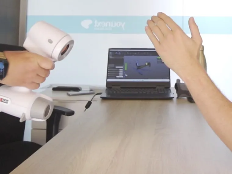 Escaneo 3D de la mano con escáner de mano profesional