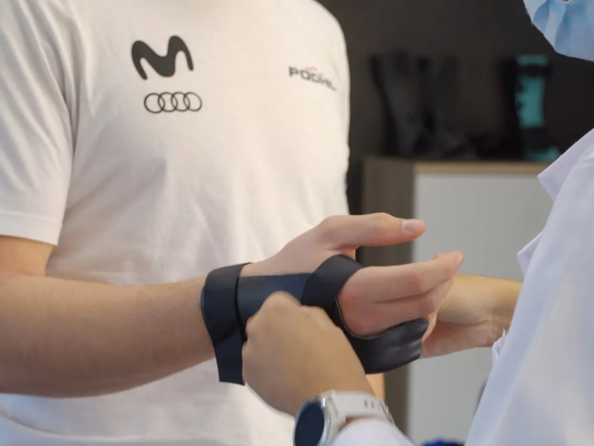 Adaptación de la férula personalizada en la mano del paciente