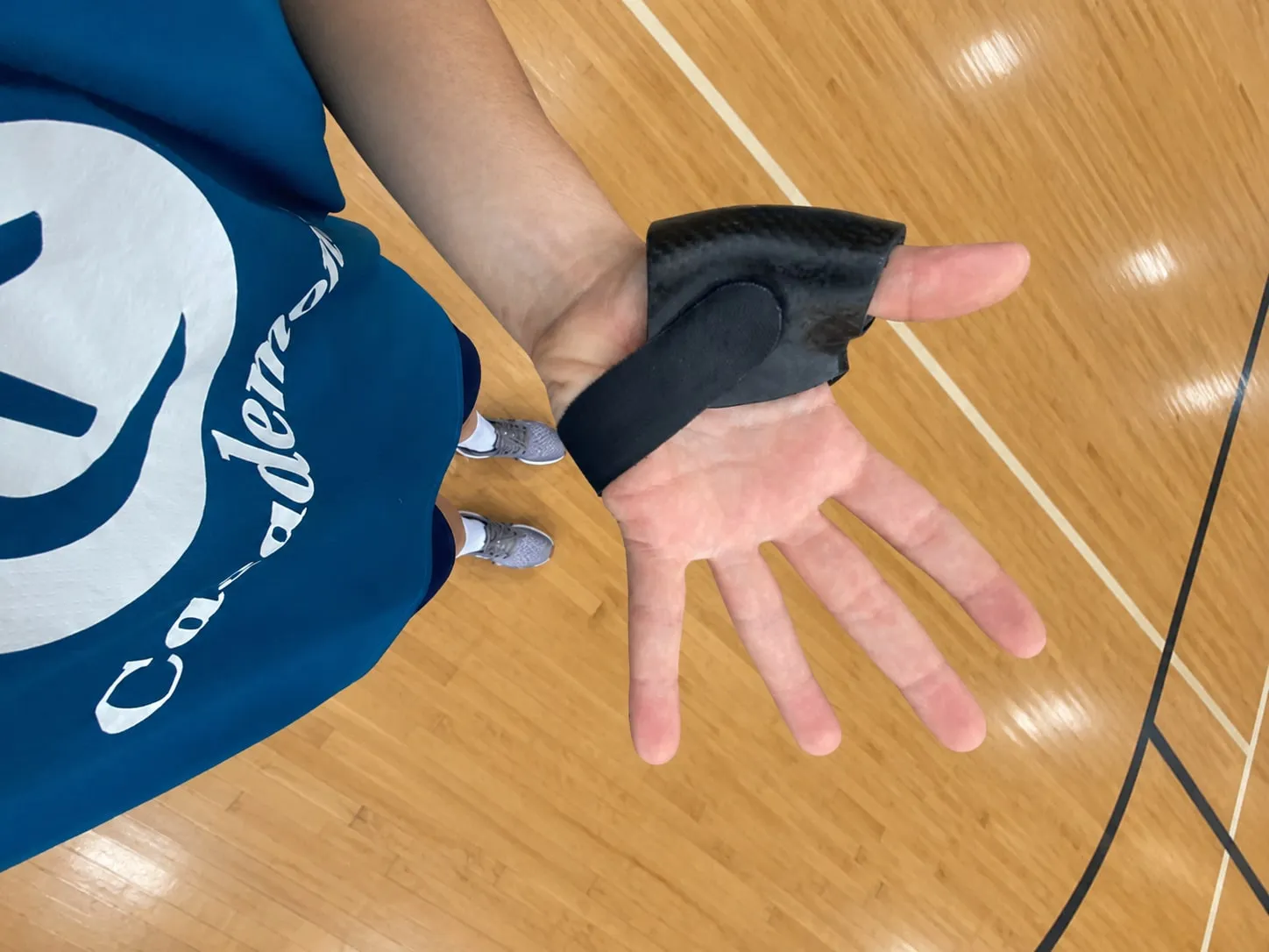 Férula de mano en fibra de carbono usada por un jugador de baloncesto en la cancha