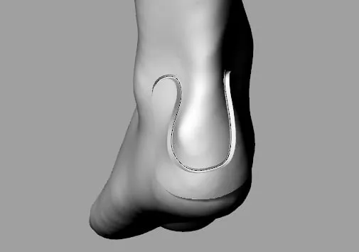 3D design of the Haglund's protector over the heel scan
