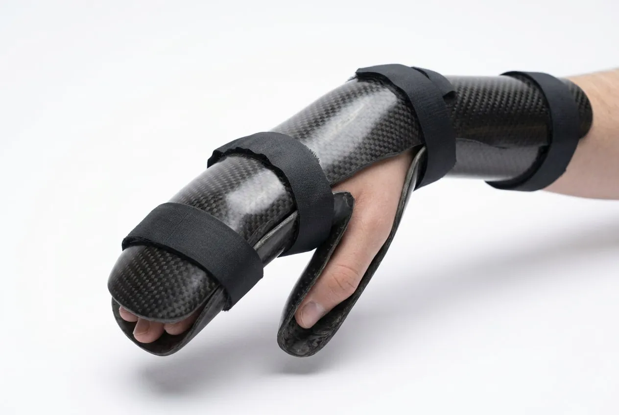 Carbon fibre hand and forearm immobilisation in place
